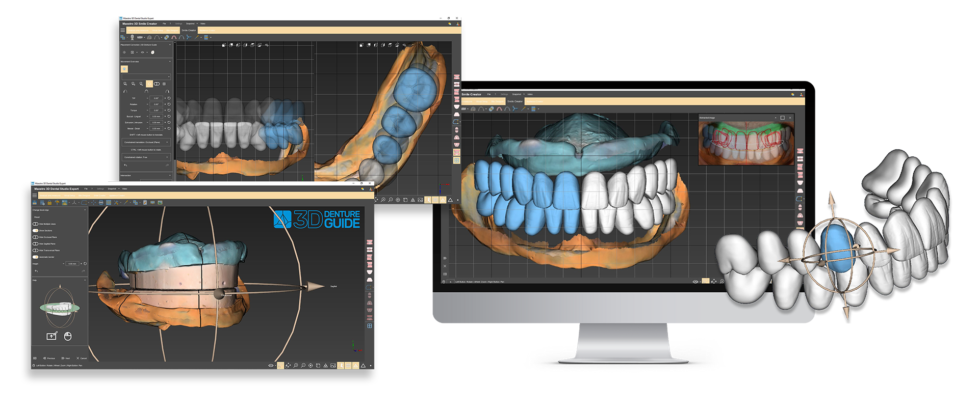monitor3d 3D Denture Guide